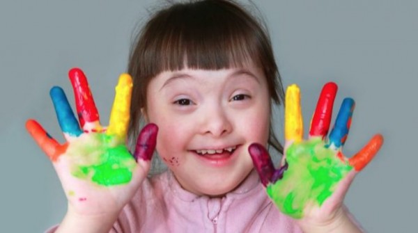downs-syndrome-680x380